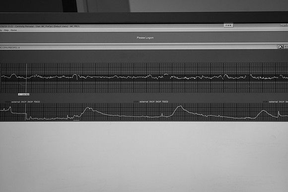Lo 061818BW-019
